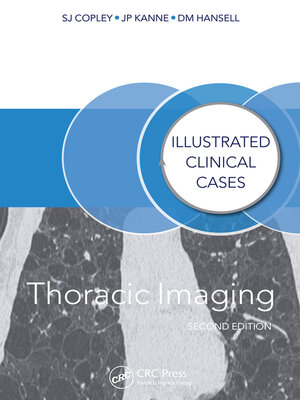 cover image of Thoracic Imaging